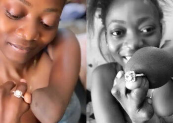 Inspiring Woman Flaunts Engagement Ring Despite Having No Fingers – Social Media Reactions Pour In