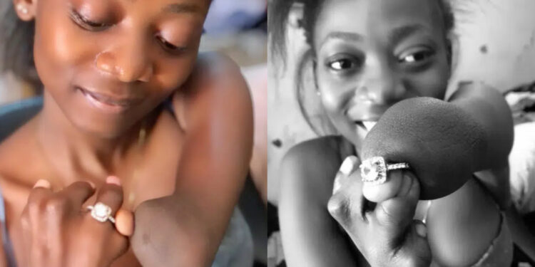 Inspiring Woman Flaunts Engagement Ring Despite Having No Fingers – Social Media Reactions Pour In
