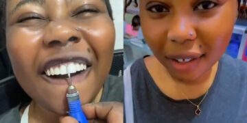 The Surprising Gap:Nigerian Women seeking to entice men Create Gaps Between Their Teeth
