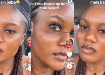 Nigerian Lady’s Faces was Redesigned from Boyfriend’s Main Girlfriend After Surprise Visit