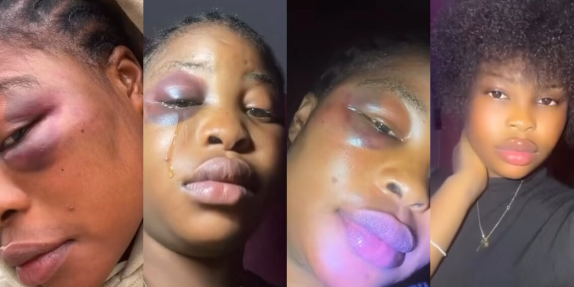Lady Shows photos of Face That Was Being Redesigned by Lovely Boyfriend
