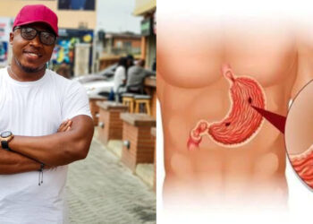 “Aproko Doctor Drops a Bombshell: You Can Get an Ulcer from Kissing?! 😂”