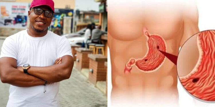 “Aproko Doctor Drops a Bombshell: You Can Get an Ulcer from Kissing?! ๐”