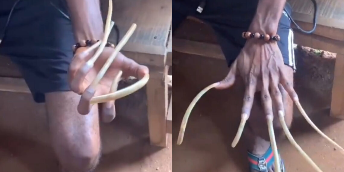 Unbelievable! Man Grows Natural Nails Over 1 Foot Long—But at What Cost?