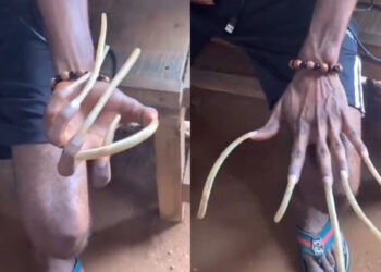 Unbelievable! Man Grows Natural Nails Over 1 Foot Long—But at What Cost?