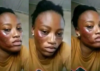 lady Seeks Ad’vice as She Post Different Photos Where Are Face Was Being Redesigned by Her Boyfriend 