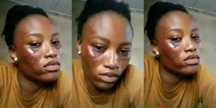 lady Seeks Ad’vice as She Post Different Photos Where Are Face Was Being Redesigned by Her Boyfriend 