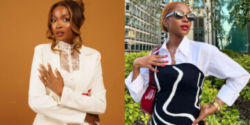 Actress Jemima Osunde Explains Her Decision to Undergo Toe Surgery