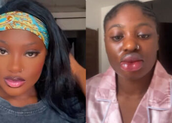 How I almost Ruined my face lady says as she shares her lip blush experience.