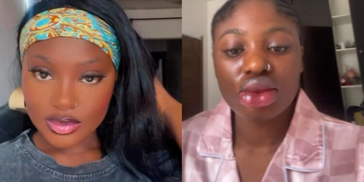 How I almost Ruined my face lady says as she shares her lip blush experience.