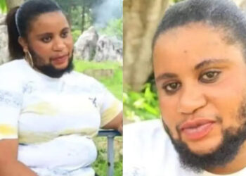 No Man Wants to marry me, They Think I Am A Transgender. Bearded Lady çries out.
