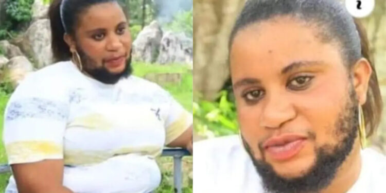 No Man Wants to marry me, They Think I Am A Transgender. Bearded Lady çries out.