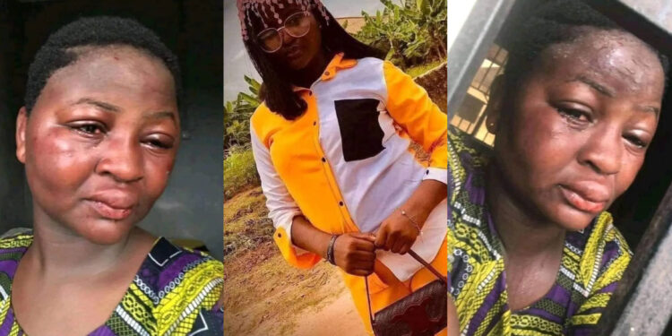  lady explained and seeks social media advice after her face was being Redesigned by her boyfriend. 