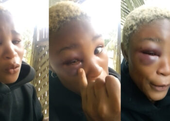 “hold your baby tight, Who you wan leave am for?” hilarious reactions trailing as Nigerian lady cries out and seeks for Justice after her Boyfriend Redesigned her one eye
