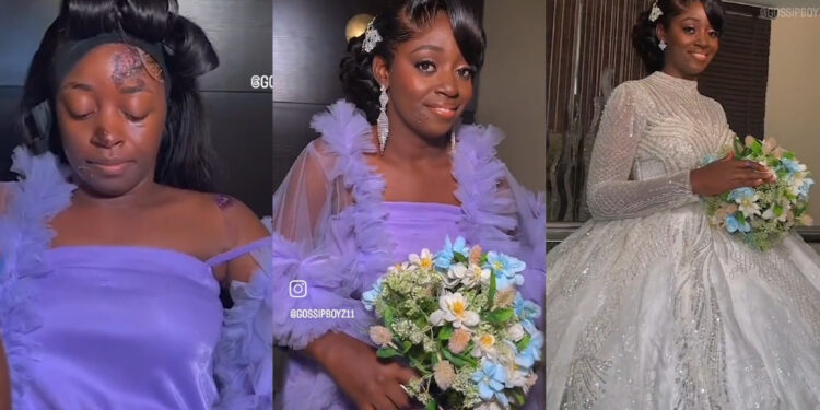 Trending Video of a lady who survive an accident 2 days to weeding, rush to the alter to say yes to the love of her life