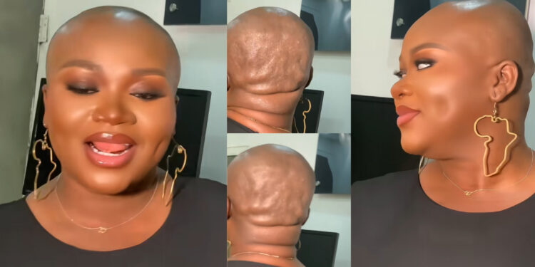 A stunning Nigerian woman, Sparks Reactions and conversations on social media as she shares an adorable video of her bold side on bald