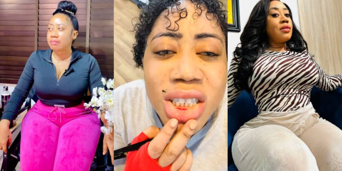 I just cut my lips, I am not going back to the gym again – Nollywood actress Moyo Lawal raised alarm as she mistakenly cut her lips why working out in the gym.