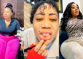 I just cut my lips, I am not going back to the gym again – Nollywood actress Moyo Lawal raised alarm as she mistakenly cut her lips why working out in the gym.