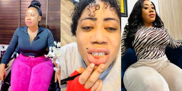 I just cut my lips, I am not going back to the gym again – Nollywood actress Moyo Lawal raised alarm as she mistakenly cut her lips why working out in the gym.