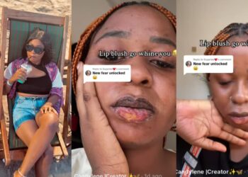 Woman Draws Attention by Sharing Results of Lip Blush Procedure.