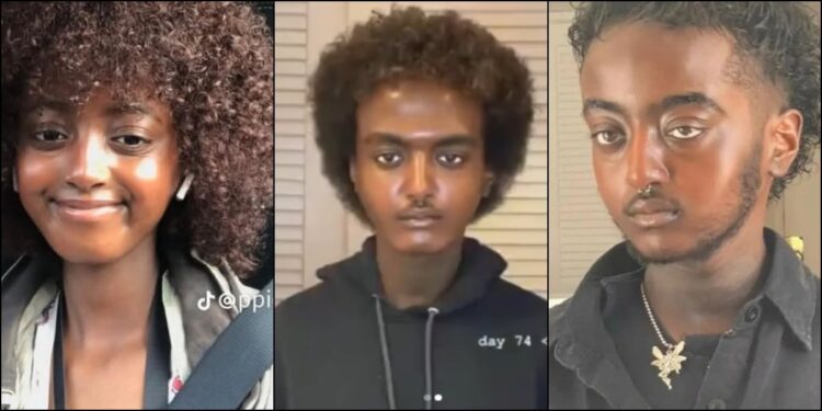 “Bobrisky’s brother”- Woman Becomes a Man After Surgery