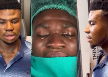 Mixed reactions as Zicsaloma unveils his healing new nose after surgery