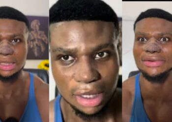 “My siblings used to call it big and ugly”- Comedian  Zicsaloma shares update on his nose surgery, explains why he did it