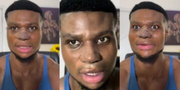 “My siblings used to call it big and ugly”- Comedian  Zicsaloma shares update on his nose surgery, explains why he did it