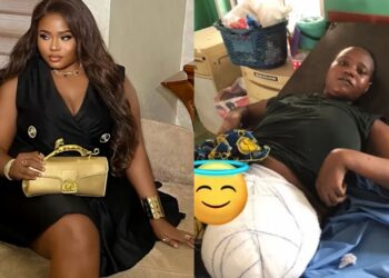 Young lady celebrates miraculous survival one year after losing leg to cancer